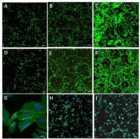 Calcein AM/PI staining and rhodamine phalloidin staining of USCs on ...