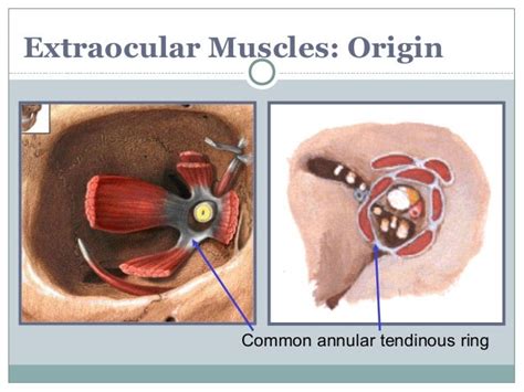 Orbit and Extra-Ocular Muscles