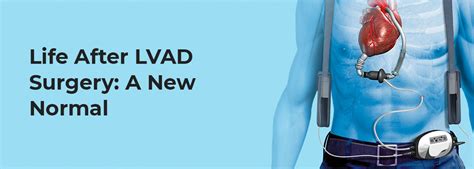 Life After LVAD Surgery: A New Normal