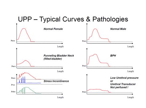 Urodynamics / Urodynamic Study - Urology Malaysia