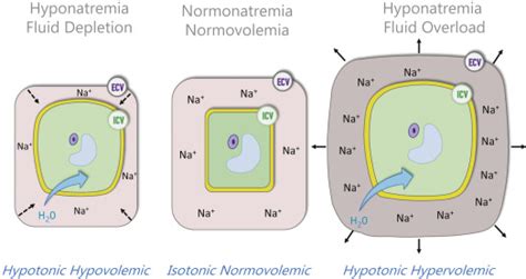 Predialysis Hyponatremia and Positive Change of Natremia Within ...