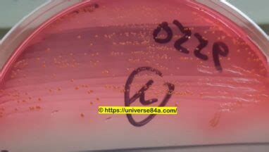 Enterococcus faecium: Introduction, Morphology, Pathogenicity, Lab