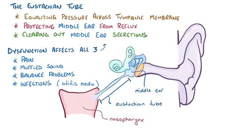 Eustachian tube dysfunction: Video & Anatomy | Osmosis