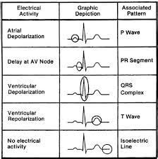 pqrst wave | Nurse, Cardiac nursing, Nursing school