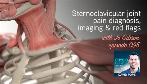 Sternoclavicular Joint Sprain