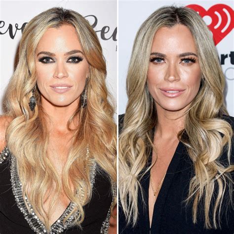 Real Housewives' Plastic Surgery: Before and After Photos