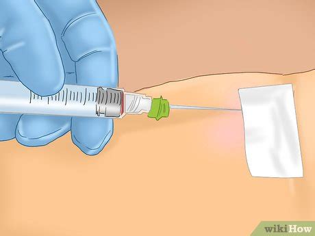 How to Treat a Staph Infection: 14 Steps (with Pictures) - wikiHow