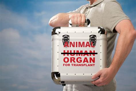 Pig Kidney Transplant: Is it the future of Kidney Transplant? - Avoid ...