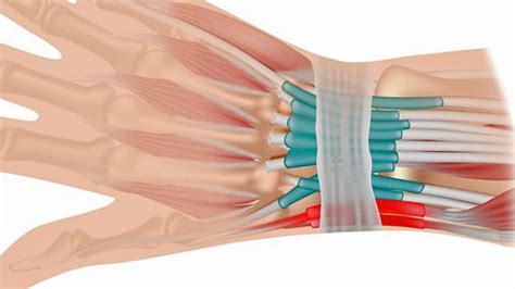 Wrist Tendonitis Symptoms and Treatment - Injury Health Blog