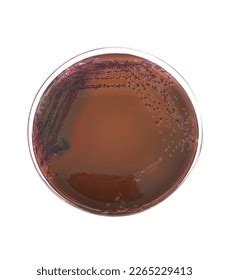 Bacterial Colonies On Eosin Methylene Blue Stock Photo 2265229413 | Shutterstock