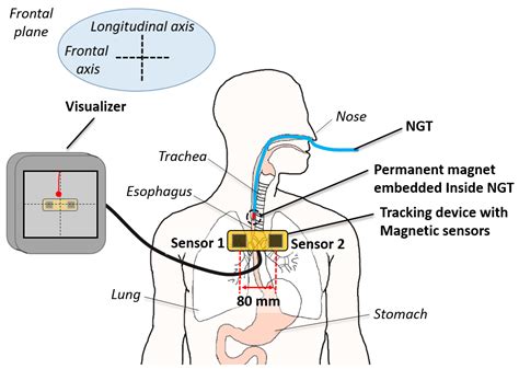 Sensors | Free Full-Text | A Low-Cost, Point-of-Care Test for ...