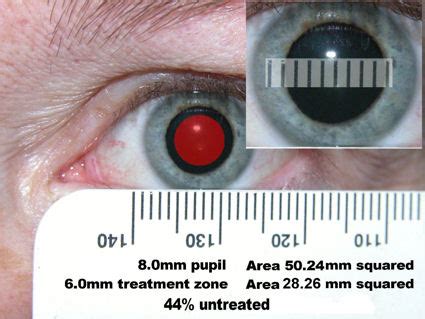 reachjafk - Pupil dilation chart