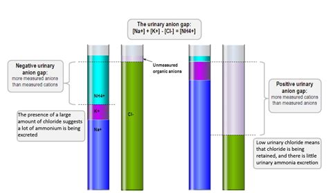 The urinary anion gap in normal anion gap metabolic acidosis | Deranged Physiology