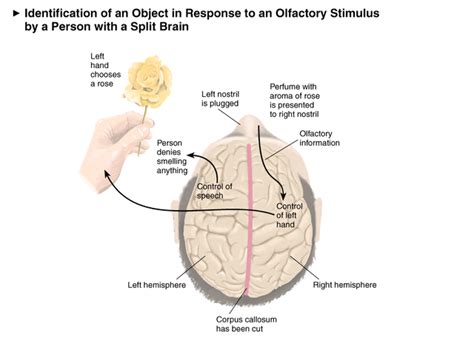 Biological Psychology: Split Brain