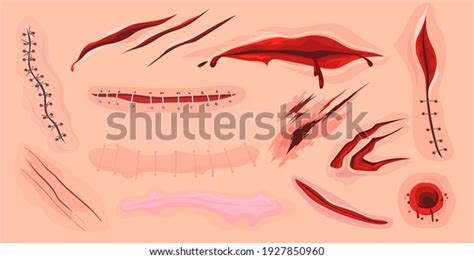 Human Skin Scars Cuts Bloody Wounds Stock Vector (Royalty Free ...