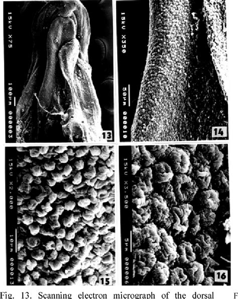 Figure 13 from The fine structure of the dorsal lingual epithelium of the scincine lizard ...