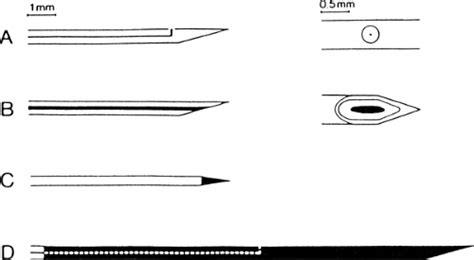 Advanced Needle EMG Methods | Musculoskeletal Key