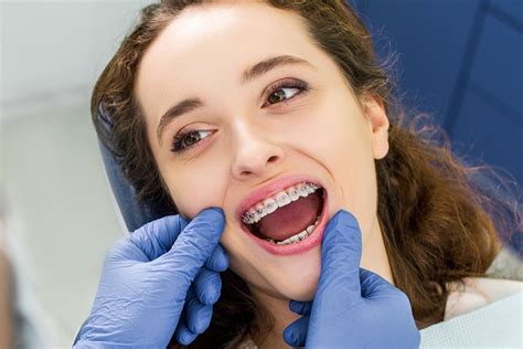 4 Common Teeth Straightening Options From an Orthodontist - Brooklyn ...