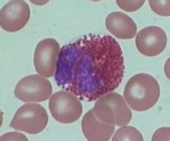 HEMATOLOGY LAB QUIZ WBC OCT 8, 2014 Flashcards | Quizlet