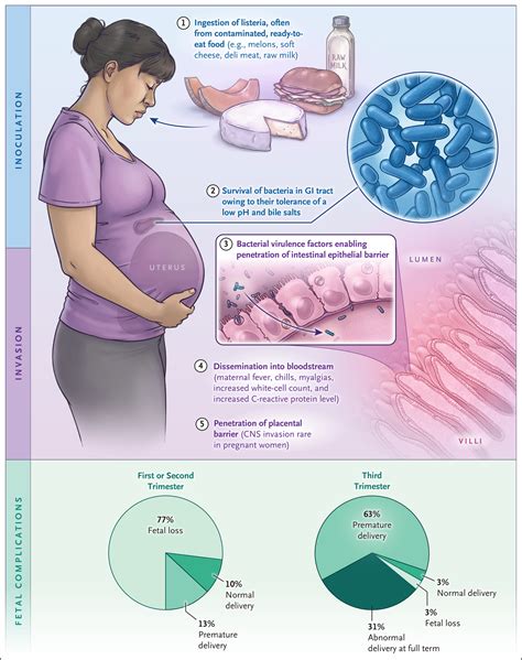 Case 21-2021: A 33-Year-Old Pregnant Woman with Fever, Abdominal Pain ...