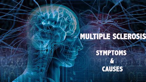 Multiple sclerosis - Symptoms and Causes | Psyspeaks