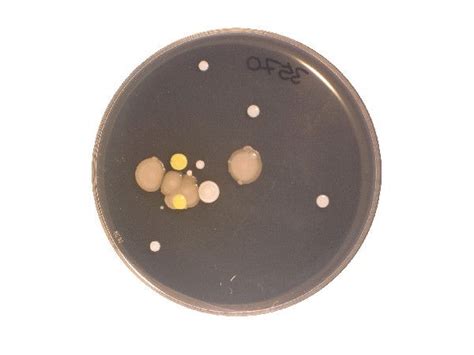 Gallery: Bacteria in Your Belly Button | Live Science