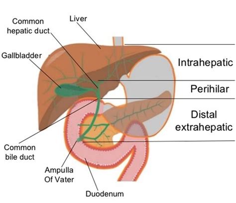 Gastrointestinal Surgery - Ampullary Cancer