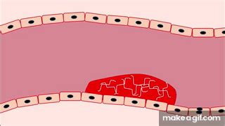 Fibrinolytics || Tissue plasminogen activators on Make a GIF