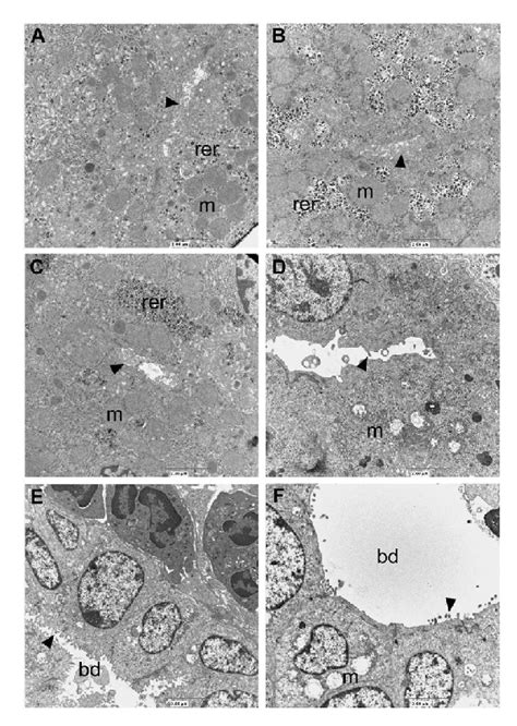 Transmission electron microscopy of bile canaliculi and small bile ...