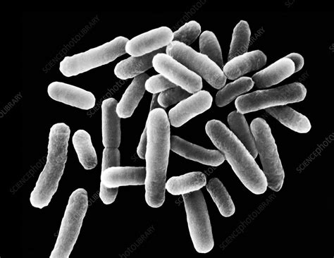 Legionella pneumophila, bacterium, SEM - Stock Image - C037/0180 - Science Photo Library