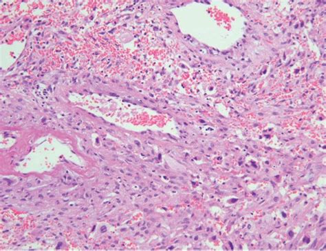 Photomicrograph identified trophoblastic cells within the ovarian... | Download Scientific Diagram