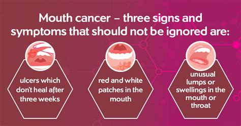 Mouth Cancer Symptoms Pictures Nhs England - Infoupdate.org