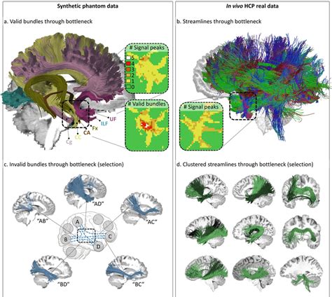 Fundamental ill-posedness of tractography. (a) Visualization of six ...