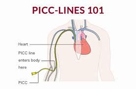 Assessment & Careplan for PICC - Peripherally Inserted Central Catheter