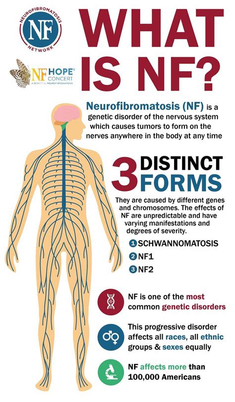 Neurofibromatosis Type 1, Yoga Anatomy, Rare Disease, Chromosome ...