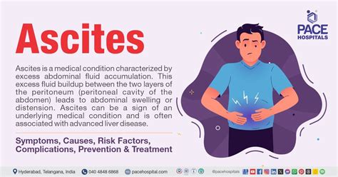 Ascites - Symptoms, Causes, Complications, Prevention, Treatment