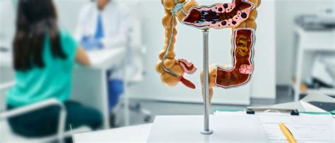 How to Know Your Colon is Healthy | ColumbiaDoctors - New York