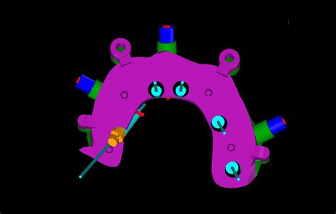 SGT Guides | Stackable Surgical Guides | Dental Implant Guided Surgery | Digital Treatment ...