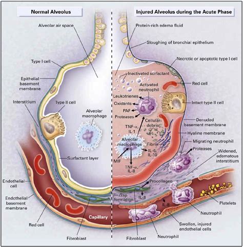 Figure 1 from Seeger Mechanisms of alveolar protein clearance in isolated rabbit lungs : Role of ...