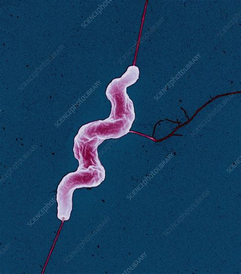 Campylobacter jejuni bacterium - Stock Image - B220/1277 - Science Photo Library