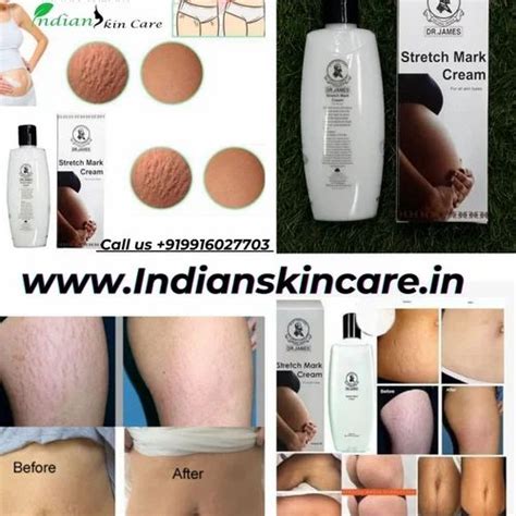 Dr James Natural Stretch Marks Removal Cream at Rs 1500/box | Stretch Marks Removal Cream in ...