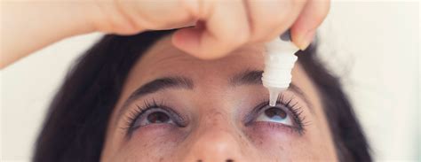 Blepharitis | Johns Hopkins Medicine