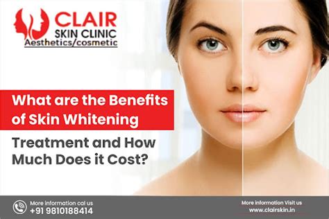 What are the Benefits of Skin Whitening Treatment and How much does it Cost