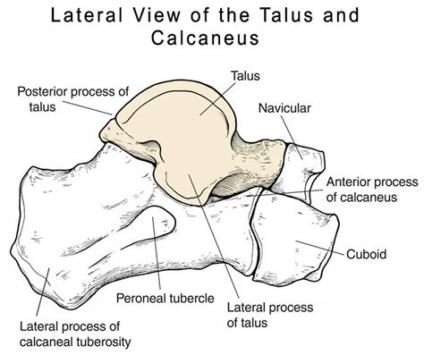 Talus fracture causes, types, symptoms, complications, diagnosis & treatment