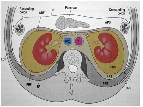 [Figure, Retroperitoneum. Image courtesy O.Chaigasame] - StatPearls - NCBI Bookshelf