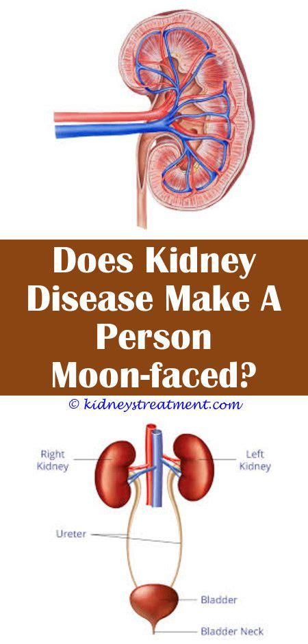 Pin on What Is Kidney Disease