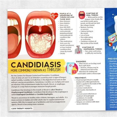 Candidiasis (Oral Thrush) – Adult and pediatric printable resources for ...