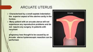 uterine abnormality | PPT