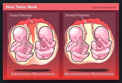 How to twins pregnancy