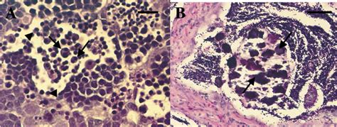 Degeneration and necrosis of spermatozoa. A: Spermatozoa, as well as... | Download Scientific ...